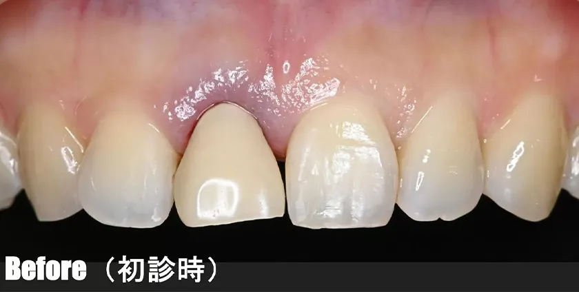 CASE01 治療前(初診時)