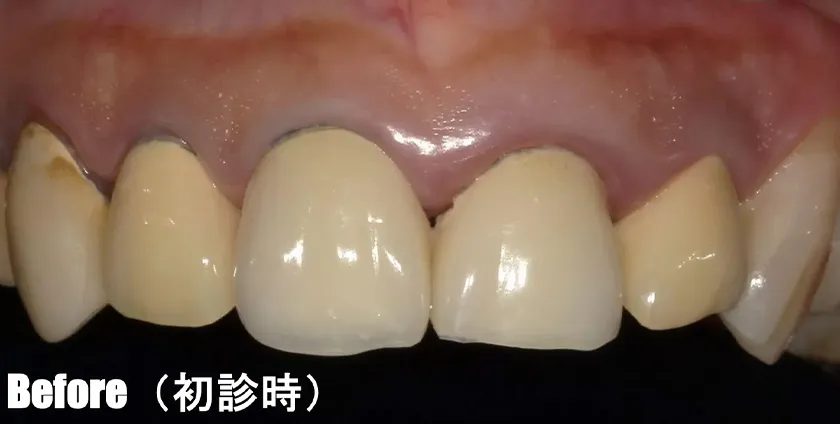CASE02 治療前(初診時)