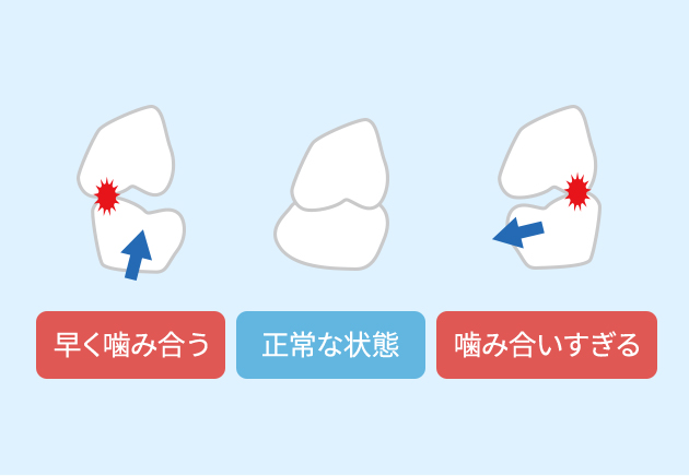歯の位置