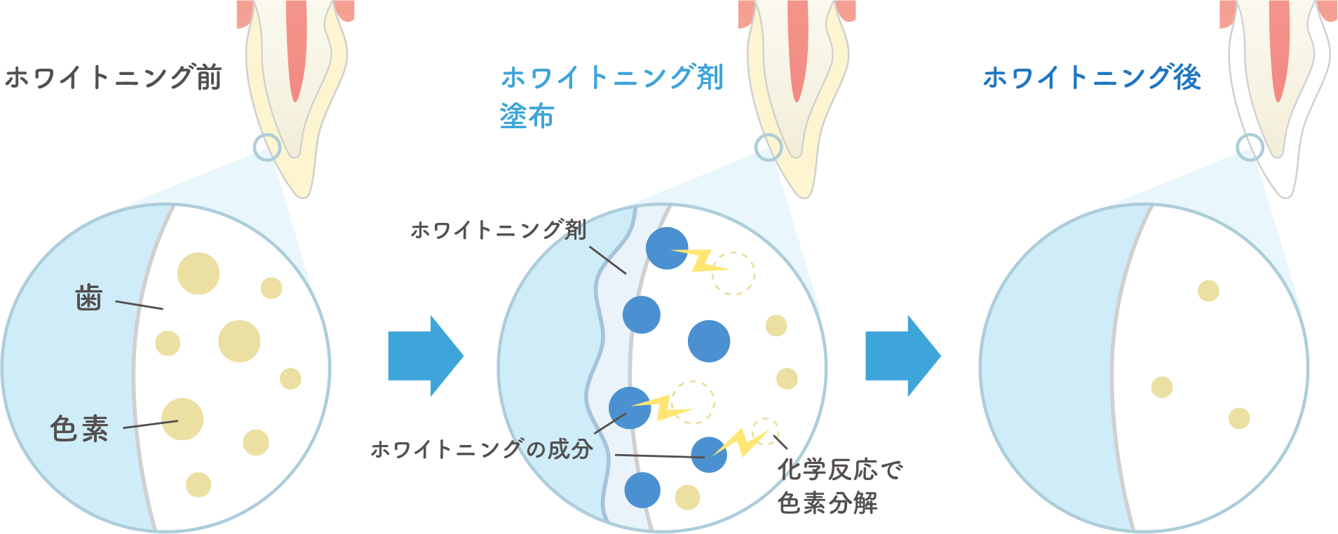 歯が白くなるメカニズム