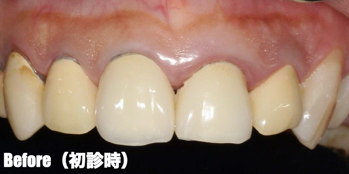 治療前