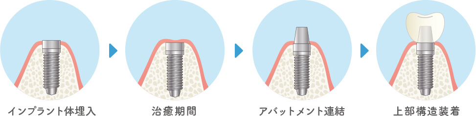 2回法