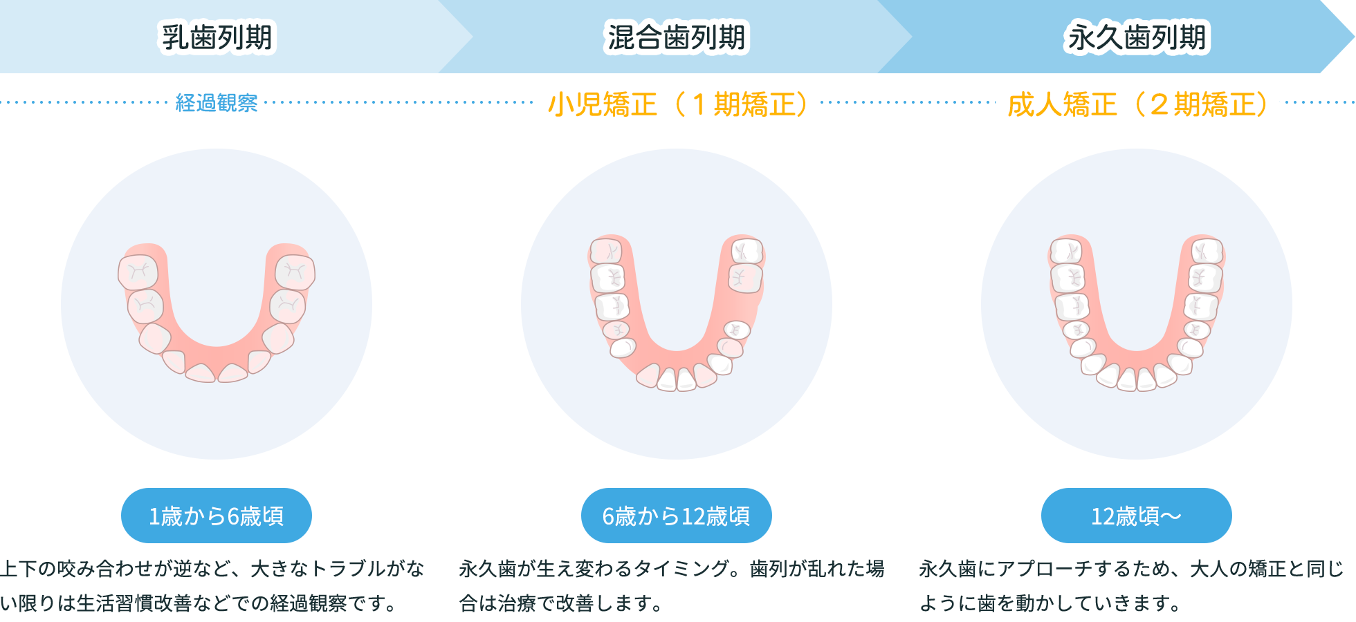子どもの歯並び治療